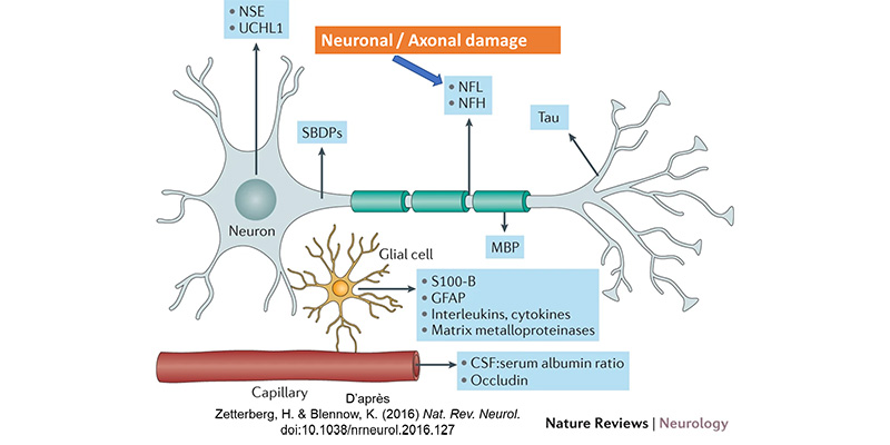 Neurofilaments